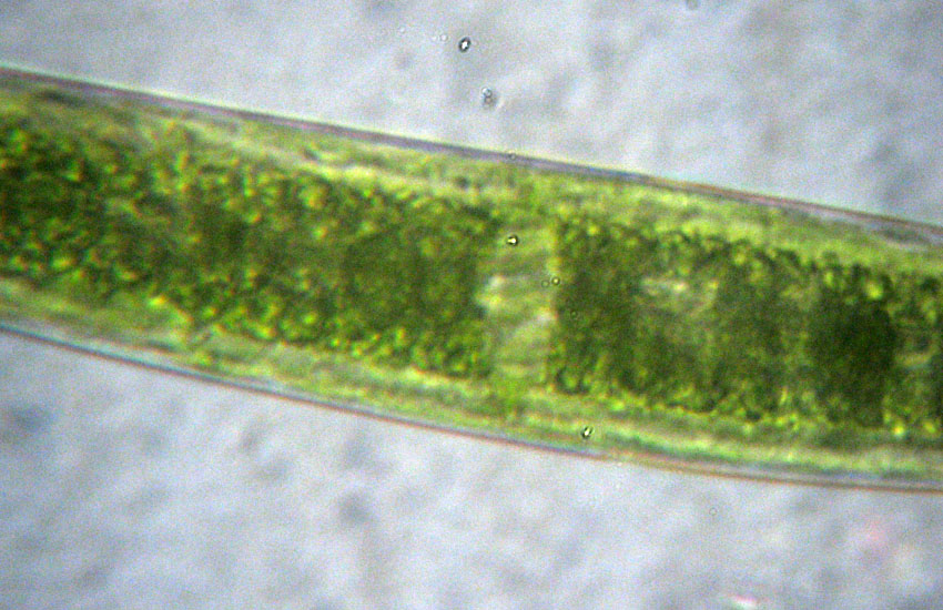 Presunzione: Closterium venus?